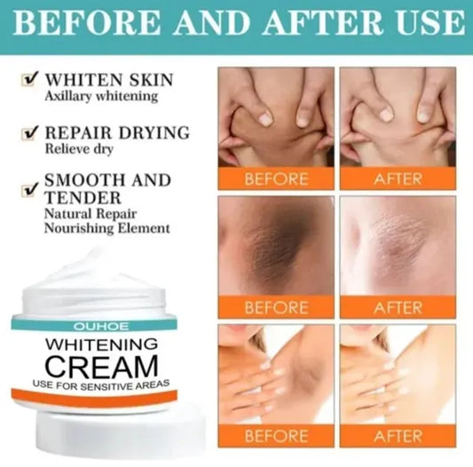 Private Parts Whitening Cream