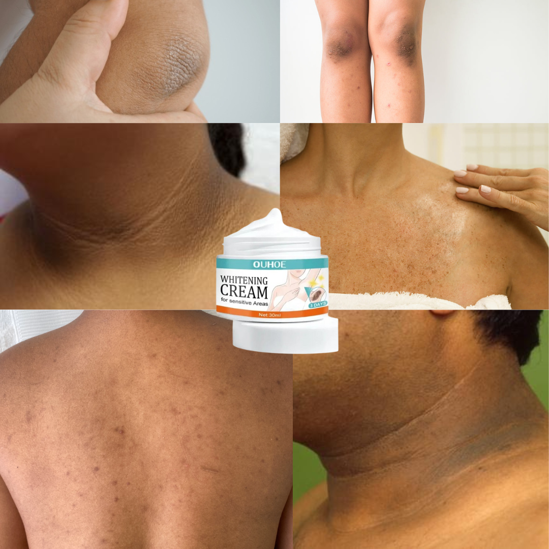 Private Parts Whitening Cream