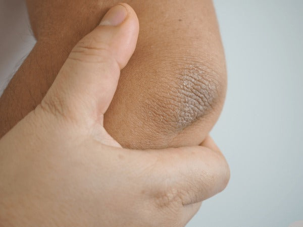 Private Parts Whitening Cream