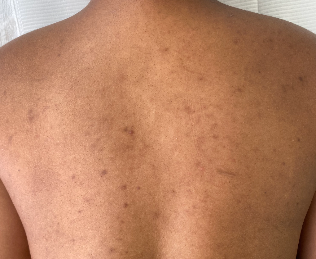 Private Parts Whitening Cream